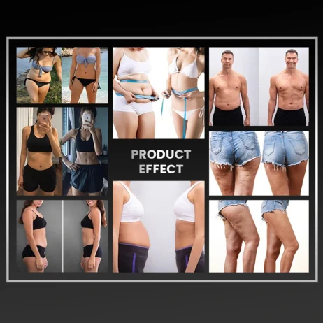 Metafora kozmeticki laseri