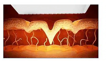 Hidrafacial 9 in 1 Multifunkcionalna masina za tretmane lica