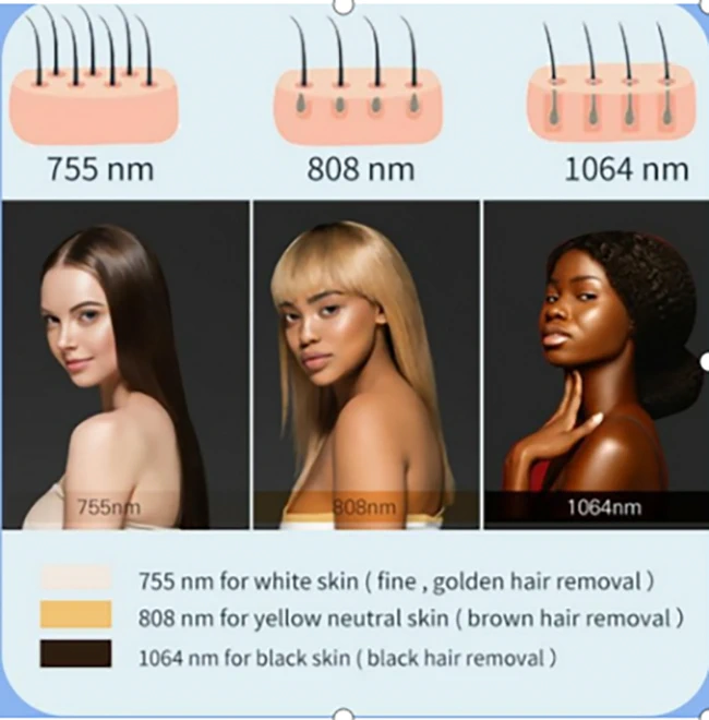 Metafora kozmeticki laseri