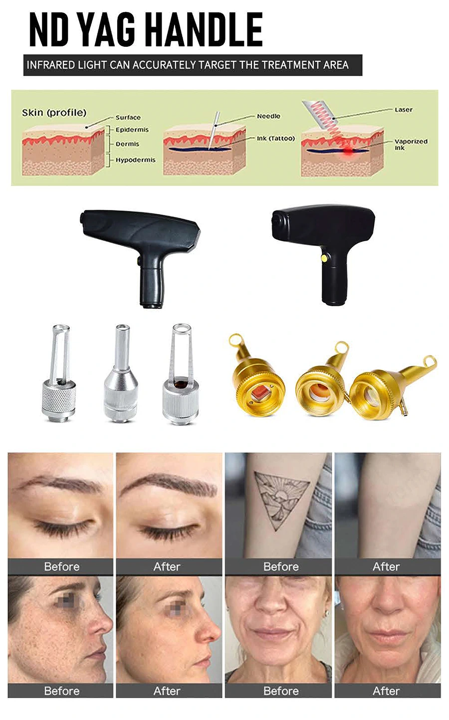 Metafora kozmeticki laseri