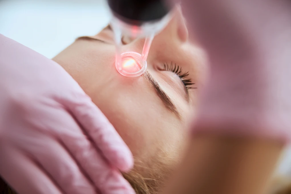 Moderni profesionalni laserski aparat za kozmetičke tretmane u salonu